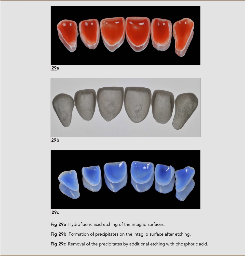 Dental Anatomical CombinationsA Guide to Ultimate Dental Esthetics