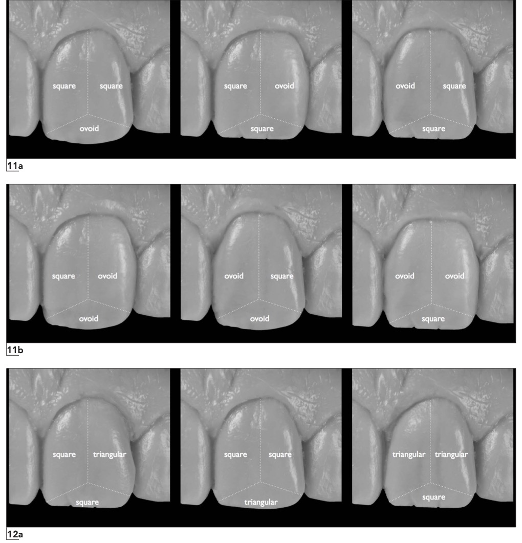 Dental Anatomical CombinationsA Guide to Ultimate Dental Esthetics